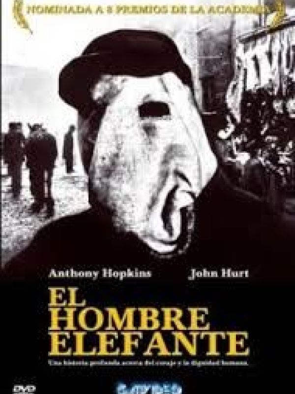 El Hombre elefante